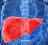 Cofepris autoriza innovador ensayo clínico para tratamiento de hígado graso